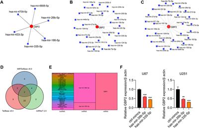 GBP2 as a potential prognostic predictor with immune-related characteristics in glioma